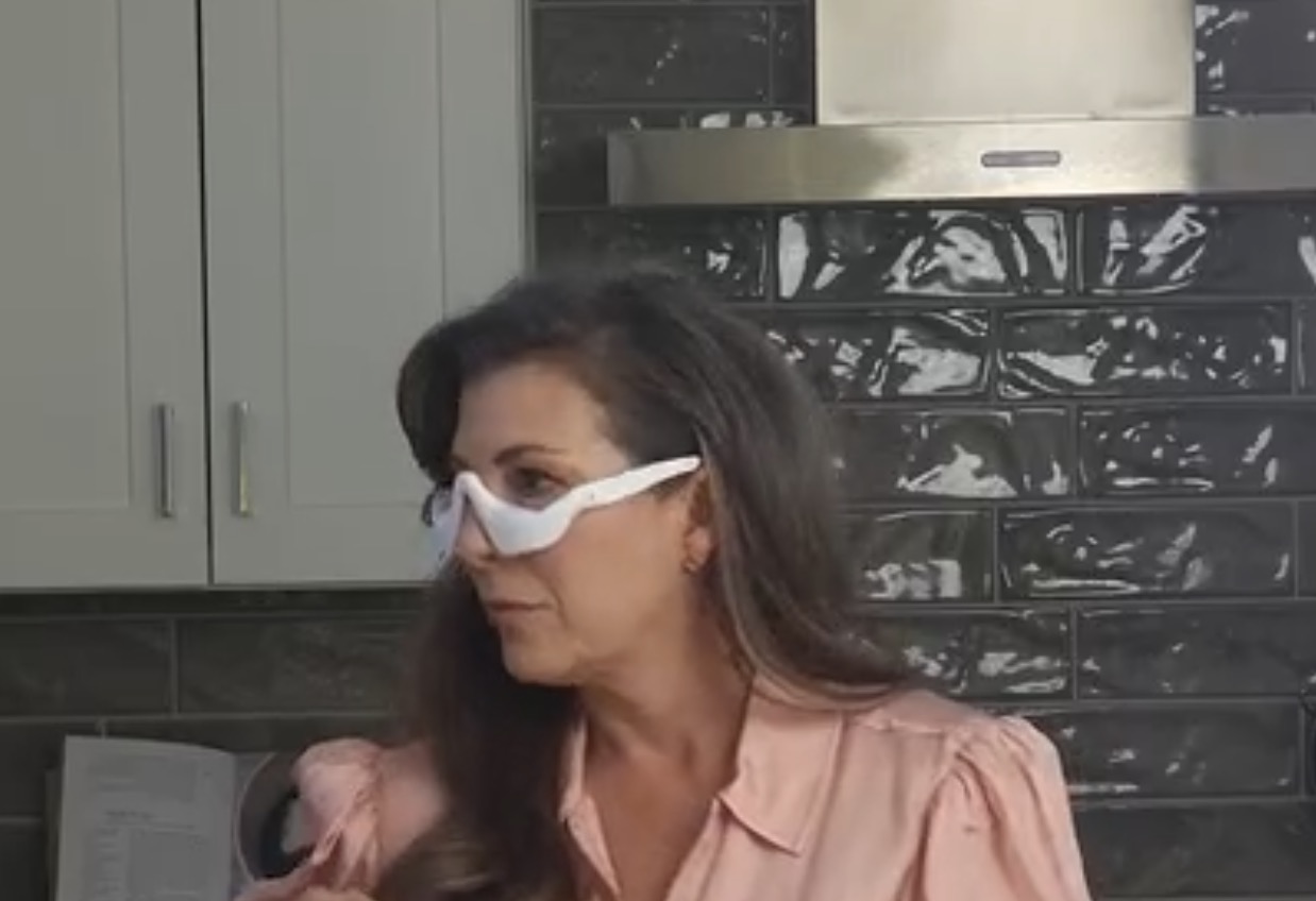 Renewa Eyelift Device